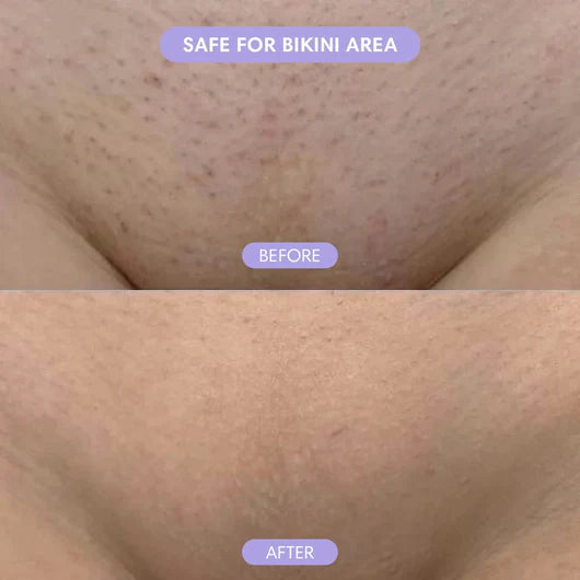 Bloomi - Hair Removal Mousse