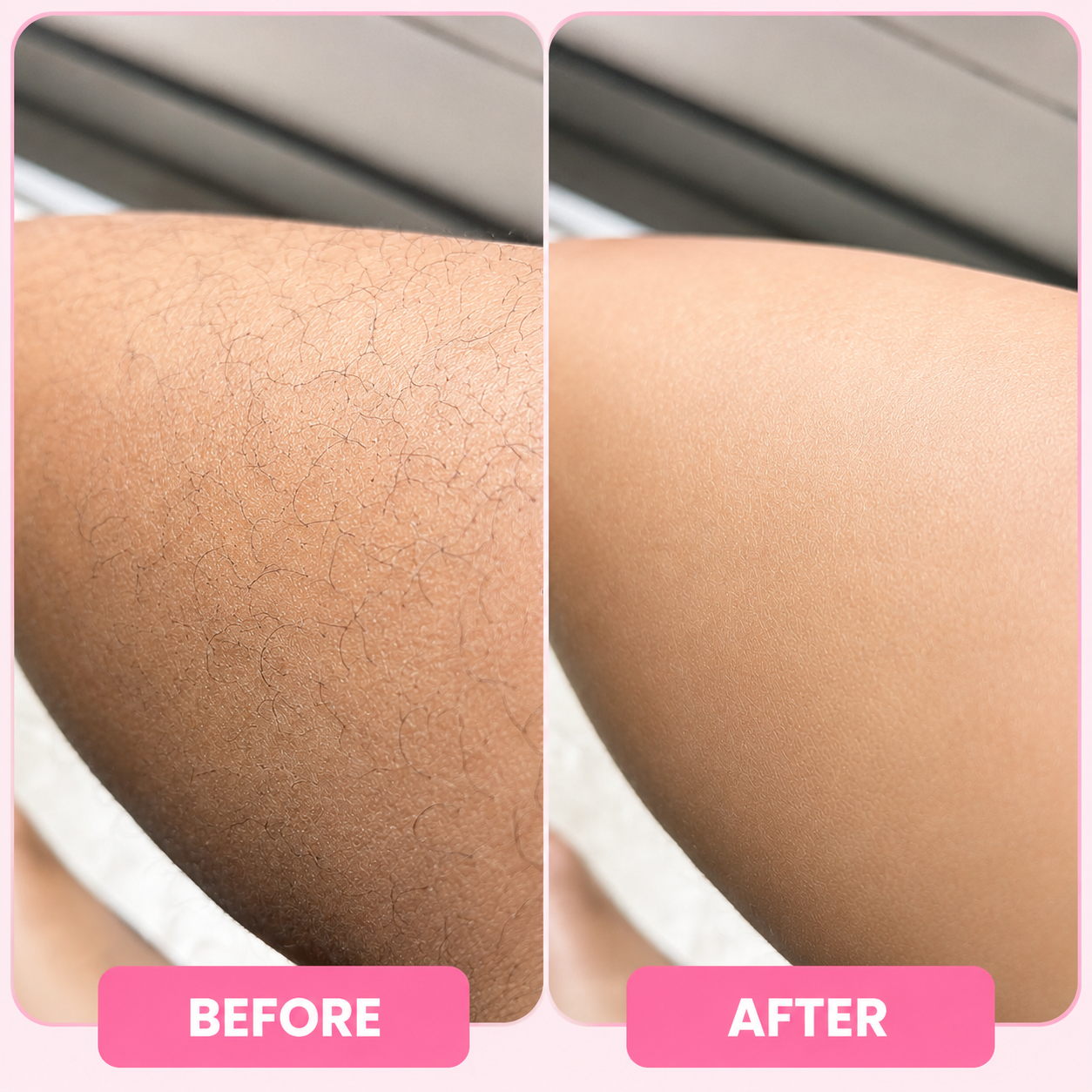 Bloomi Hair Removal Mousse
