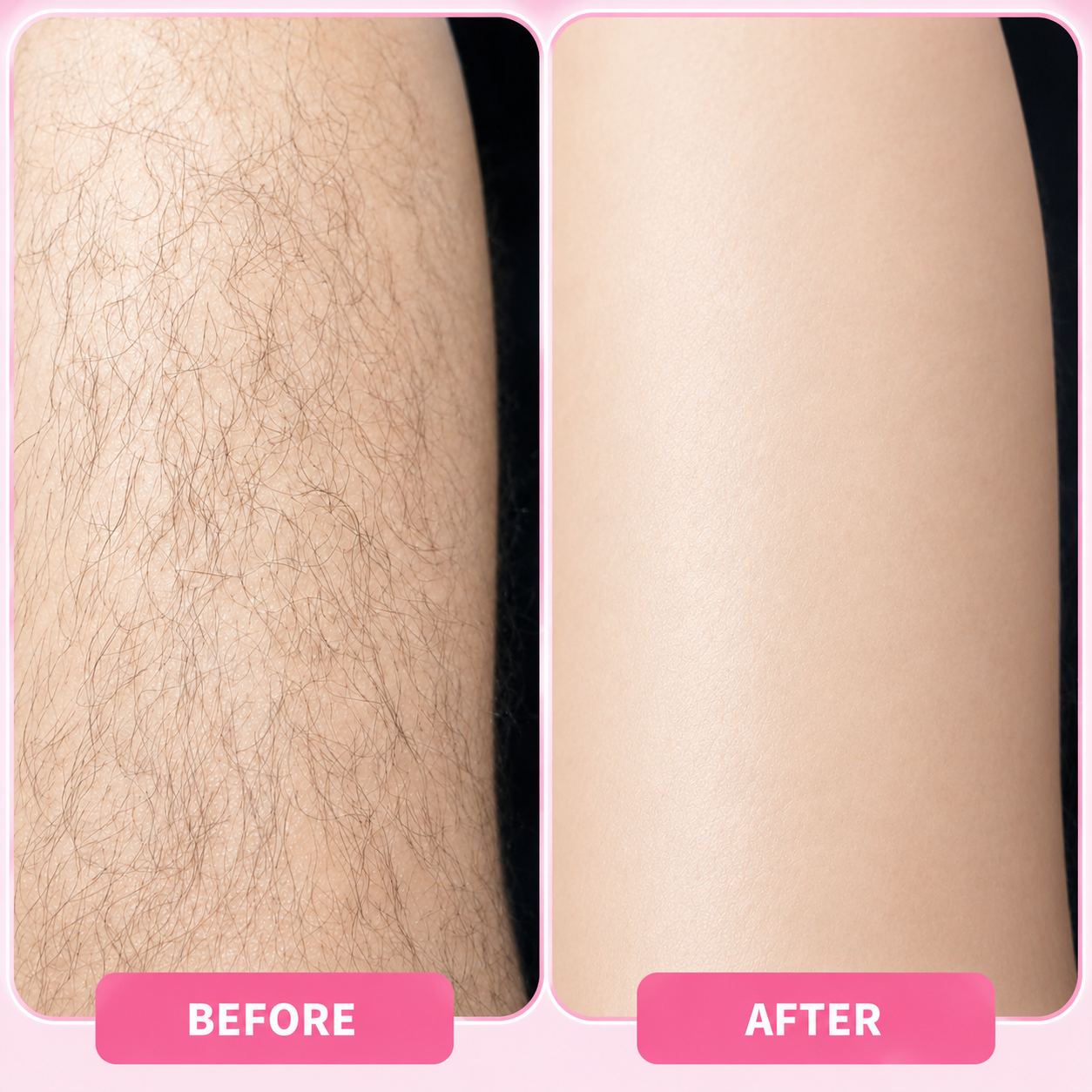 Bloomi Hair Removal Mousse