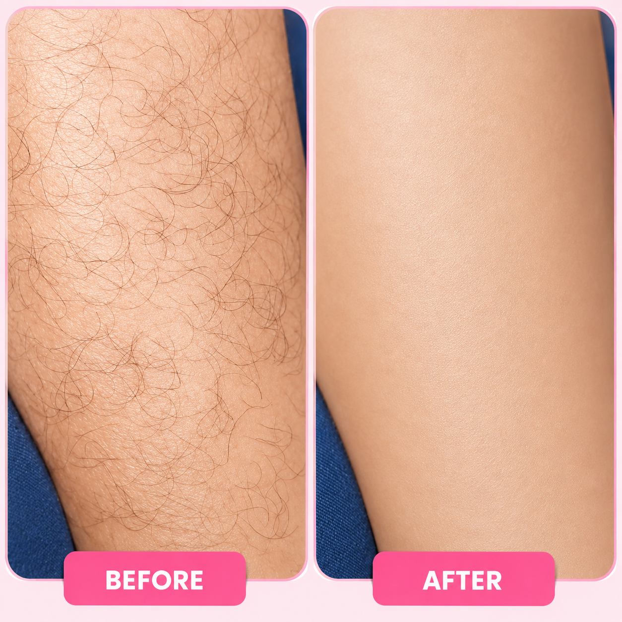 Bloomi Hair Removal Mousse