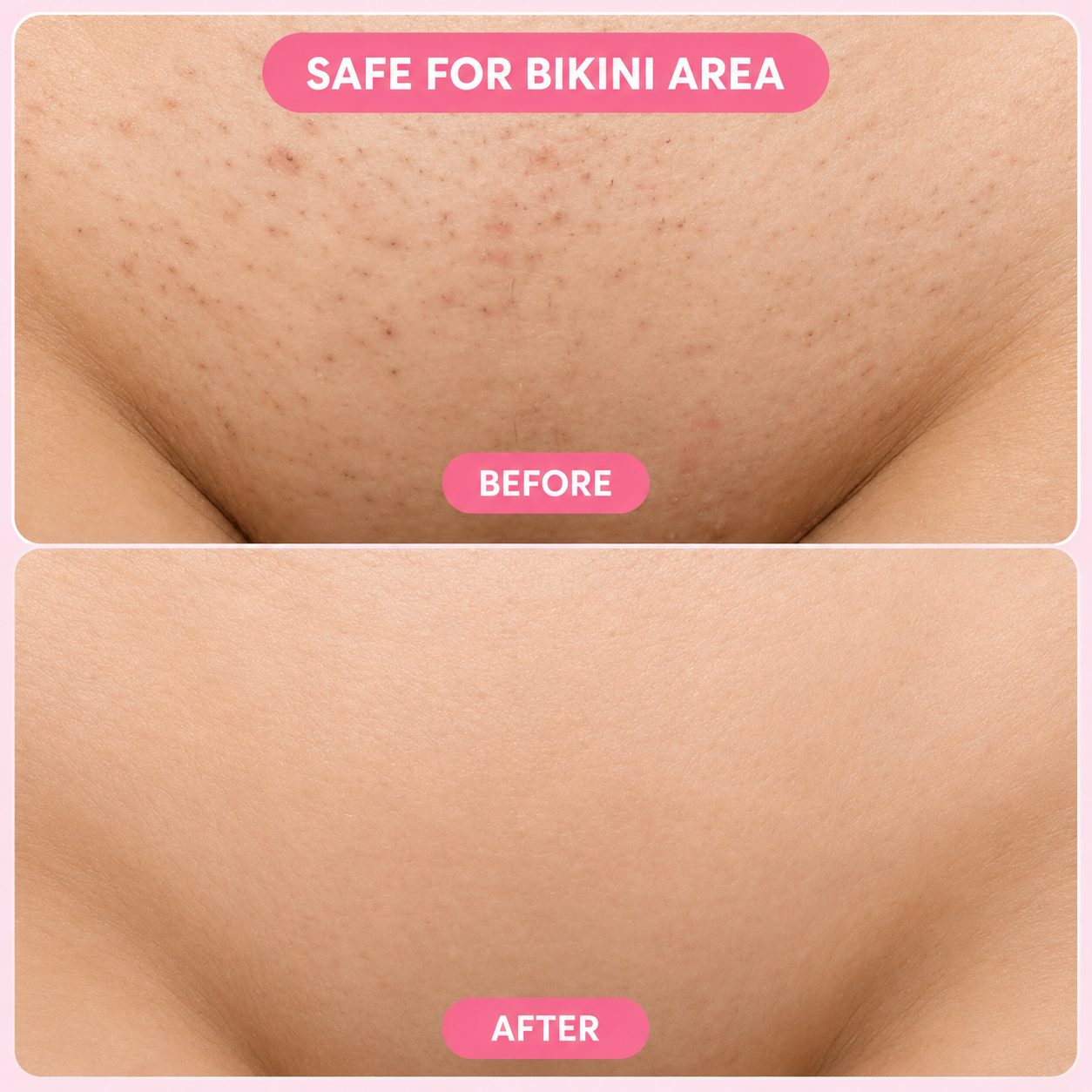 Bloomi Hair Removal Mousse