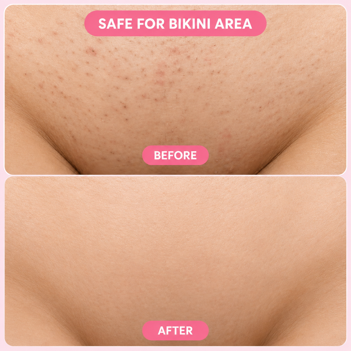 Bloomi Hair Removal Mousse
