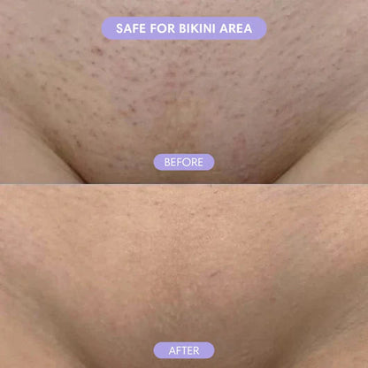Bloomi - Hair Removal Mousse
